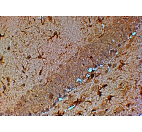 Immunohistochemistry - Anti-TRPM7 Antibody (A83778) - Antibodies.com