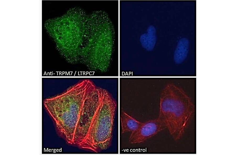 Immunofluorescence - Anti-TRPM7 Antibody (A83778) - Antibodies.com