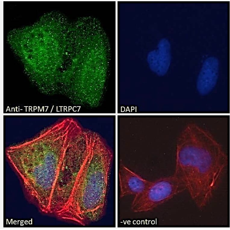 Immunofluorescence - Anti-TRPM7 Antibody (A83778) - Antibodies.com