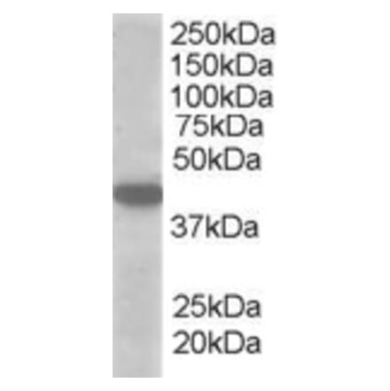 Western Blot - Anti-MCT2 Antibody (A83779) - Antibodies.com