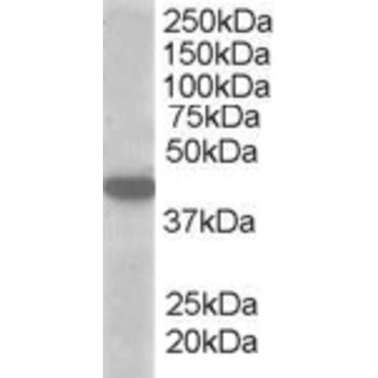 Western Blot - Anti-MCT2 Antibody (A83779) - Antibodies.com
