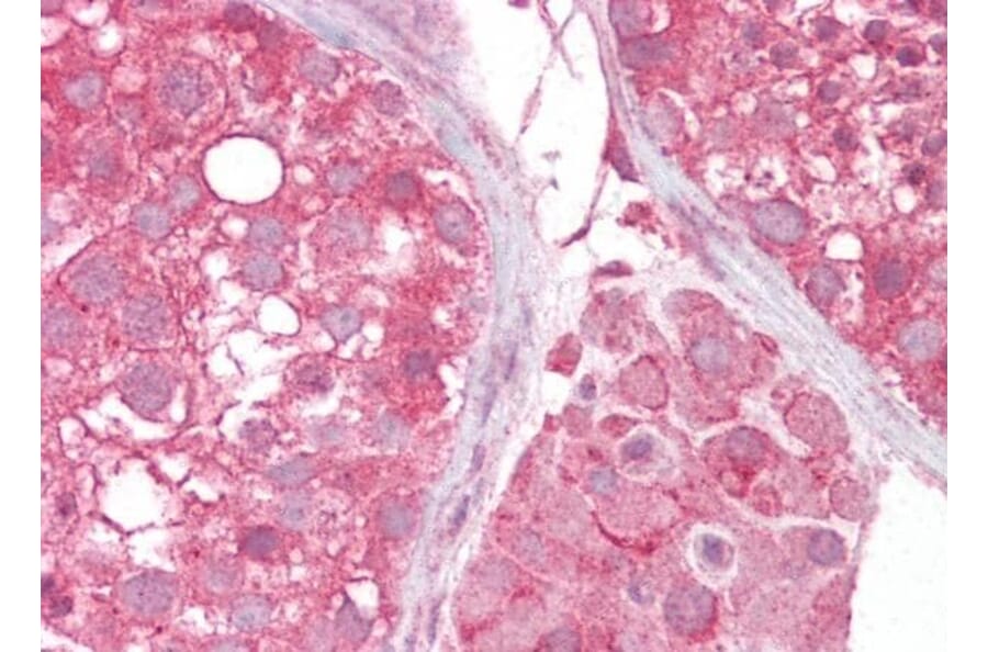 Immunohistochemistry - Anti-MCT2 Antibody (A83779) - Antibodies.com