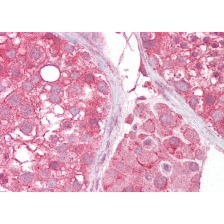 Immunohistochemistry - Anti-MCT2 Antibody (A83779) - Antibodies.com