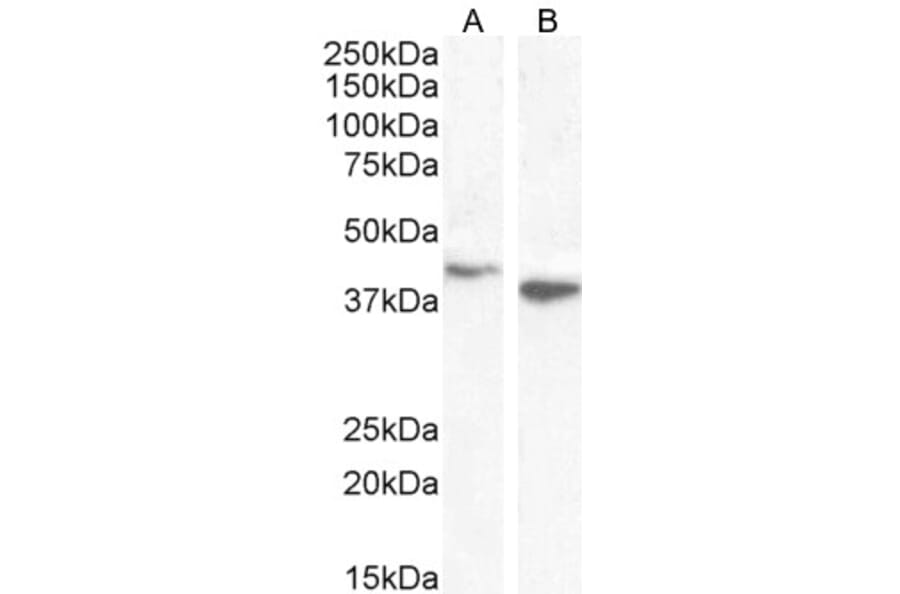 Western Blot - Anti-Bif-1 Antibody (A83782) - Antibodies.com