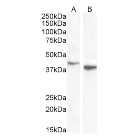 Western Blot - Anti-Bif-1 Antibody (A83782) - Antibodies.com