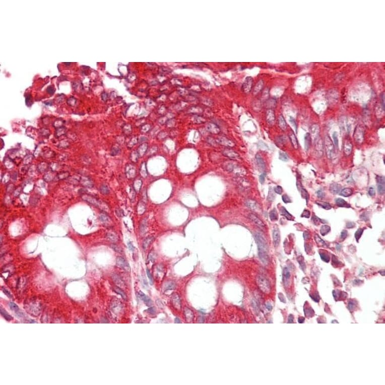AntiSH3GLB1 Antibody (A83782)