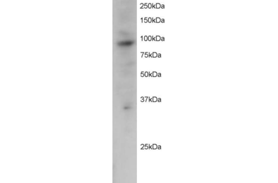 Western Blot - Anti-PRAM1 Antibody (A83783) - Antibodies.com