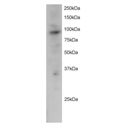 Western Blot - Anti-PRAM1 Antibody (A83783) - Antibodies.com