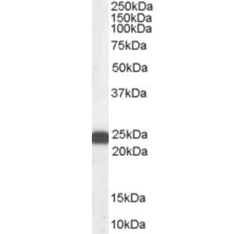 Western Blot - Anti-BAG2 Antibody (A83784) - Antibodies.com