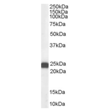 Western Blot - Anti-BAG2 Antibody (A83784) - Antibodies.com