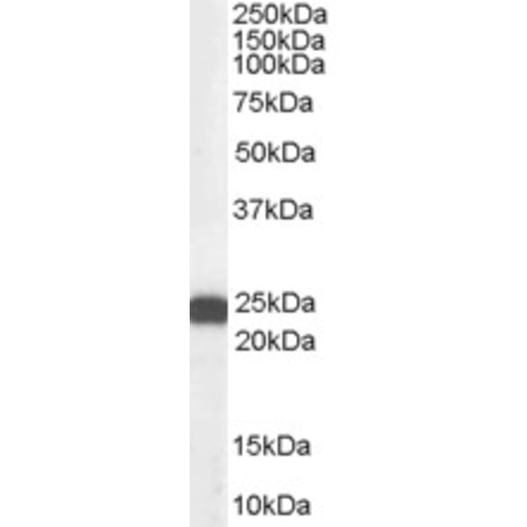 Western Blot - Anti-BAG2 Antibody (A83784) - Antibodies.com