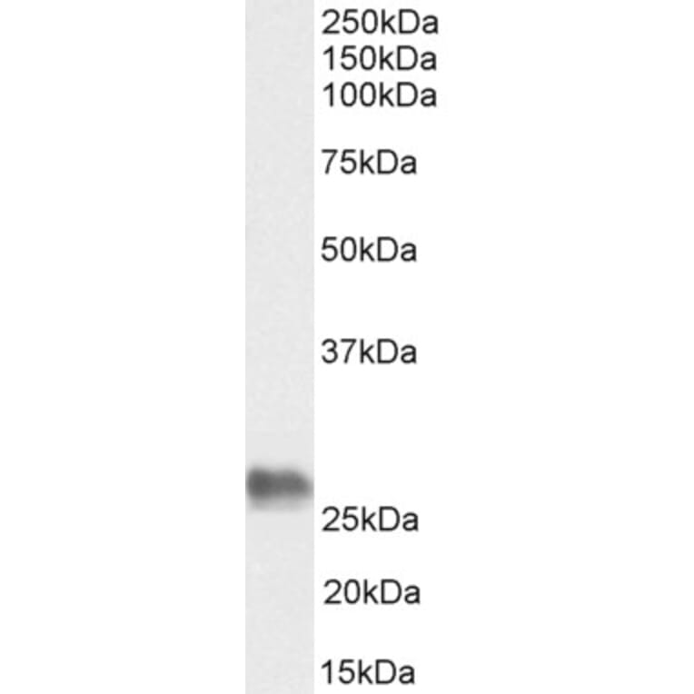 Western Blot - Anti-BAG2 Antibody (A83784) - Antibodies.com