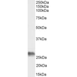 Western Blot - Anti-BAG2 Antibody (A83784) - Antibodies.com