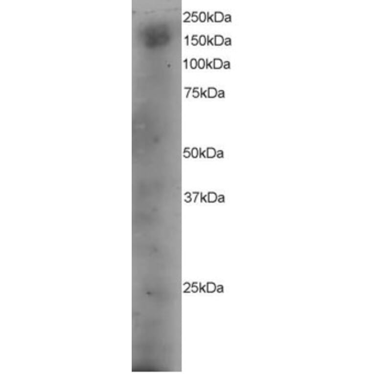 Western Blot - Anti-DOCK180 Antibody (A83785) - Antibodies.com