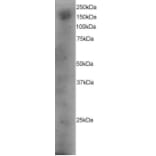 Western Blot - Anti-DOCK180 Antibody (A83785) - Antibodies.com