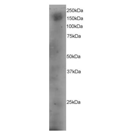 Western Blot - Anti-DOCK1 Antibody (A83785) - Antibodies.com