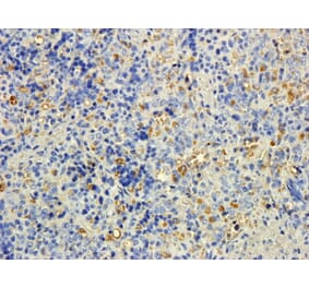 Immunohistochemistry - Anti-MTMR9 Antibody (A83786) - Antibodies.com