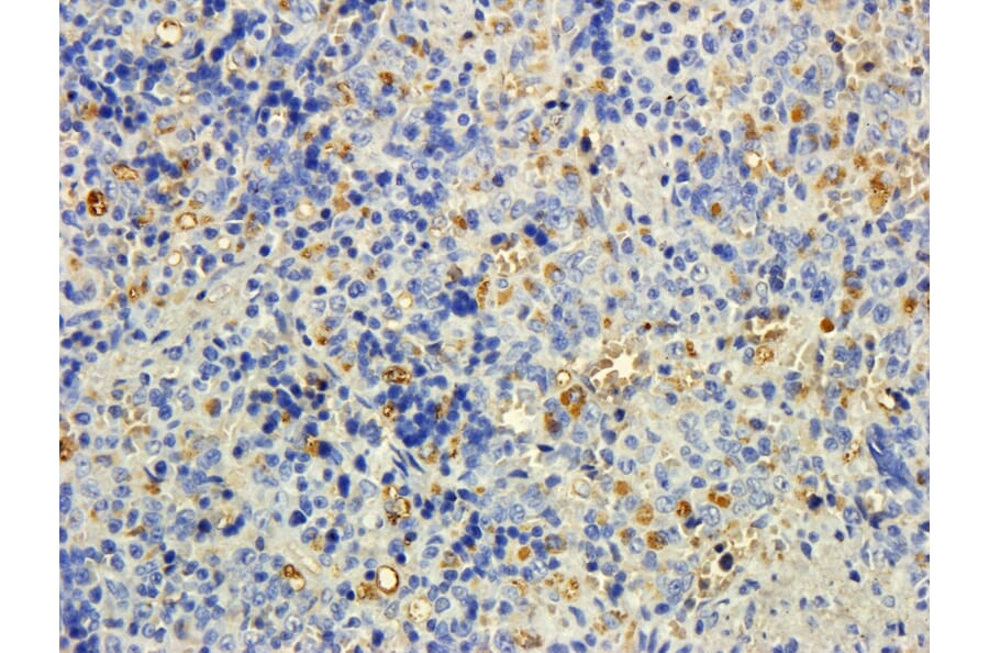 Immunohistochemistry - Anti-MTMR9 Antibody (A83786) - Antibodies.com