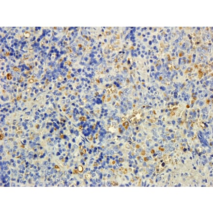 Immunohistochemistry - Anti-MTMR9 Antibody (A83786) - Antibodies.com