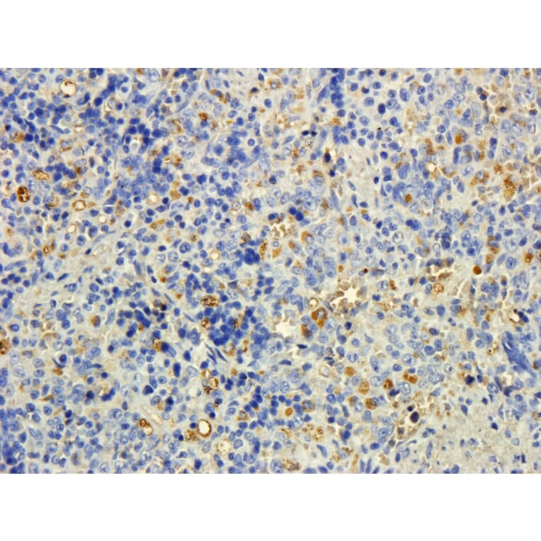 Immunohistochemistry - Anti-MTMR9 Antibody (A83786) - Antibodies.com