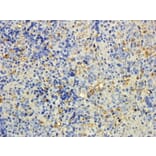 Immunohistochemistry - Anti-MTMR9 Antibody (A83786) - Antibodies.com