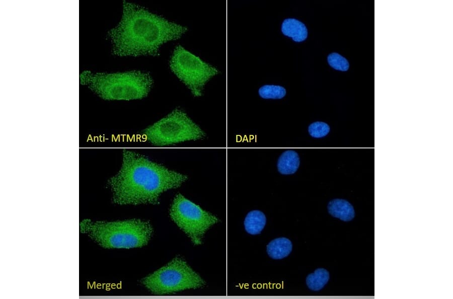Immunofluorescence - Anti-MTMR9 Antibody (A83786) - Antibodies.com