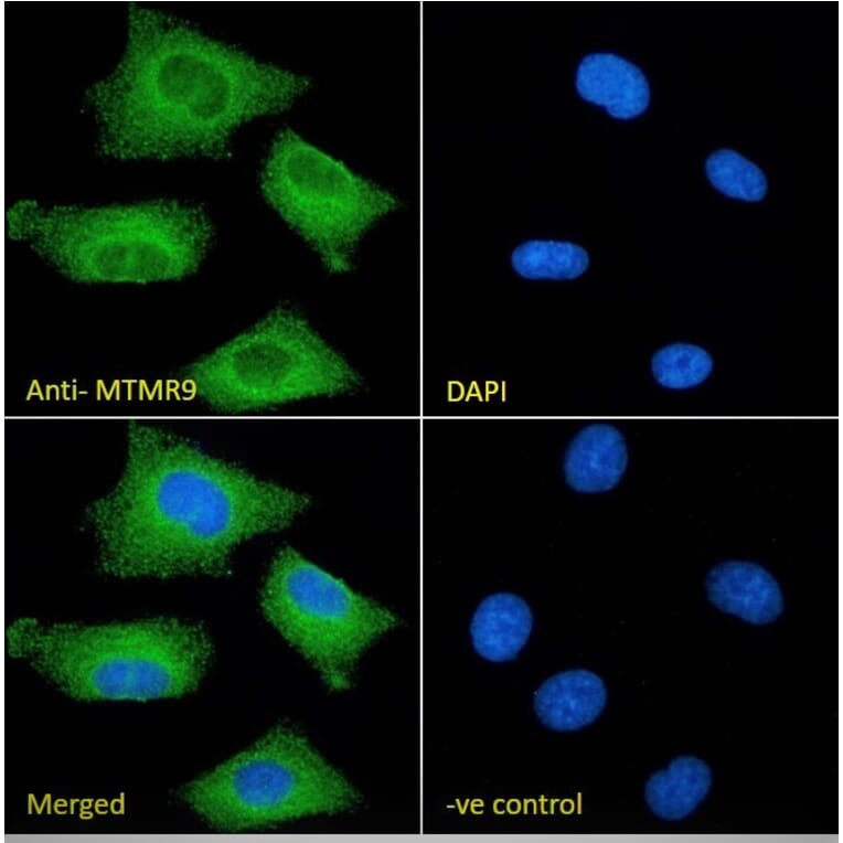 Immunofluorescence - Anti-MTMR9 Antibody (A83786) - Antibodies.com
