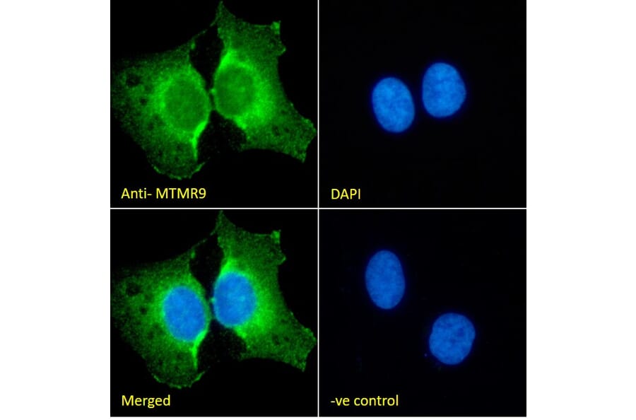 Immunofluorescence - Anti-MTMR9 Antibody (A83786) - Antibodies.com