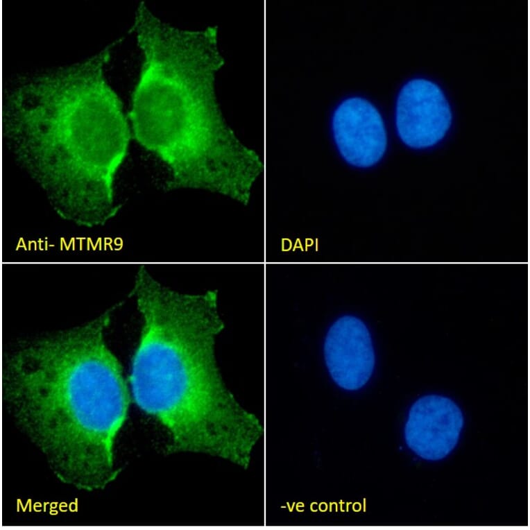 Immunofluorescence - Anti-MTMR9 Antibody (A83786) - Antibodies.com