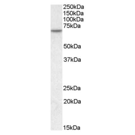 Western Blot - Anti-MTM1 Antibody (A83787) - Antibodies.com