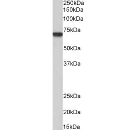 Western Blot - Anti-MTM1 Antibody (A83787) - Antibodies.com