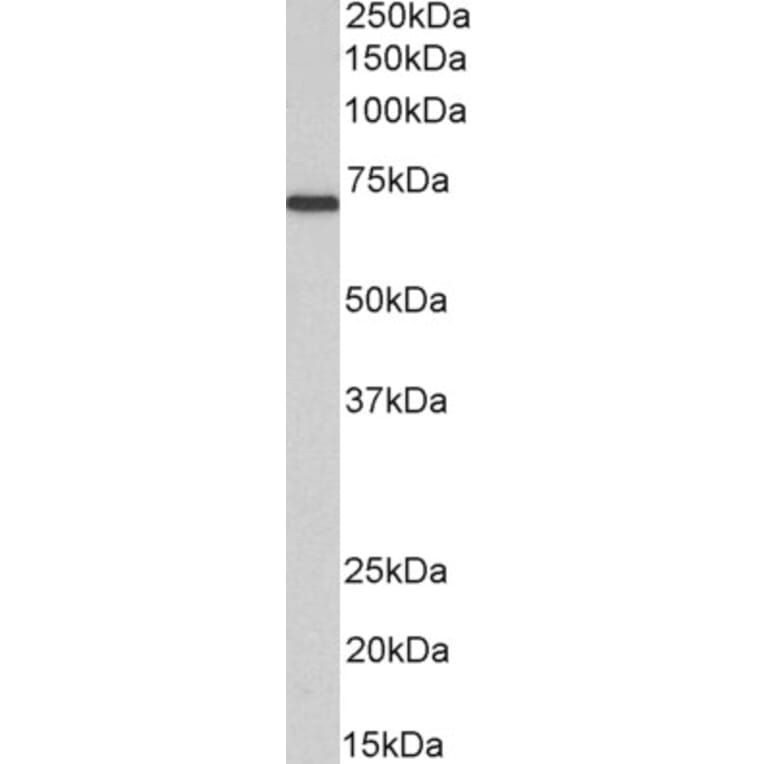Western Blot - Anti-MTM1 Antibody (A83787) - Antibodies.com