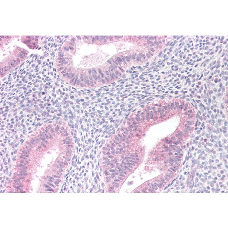 Immunohistochemistry - Anti-MTM1 Antibody (A83787) - Antibodies.com