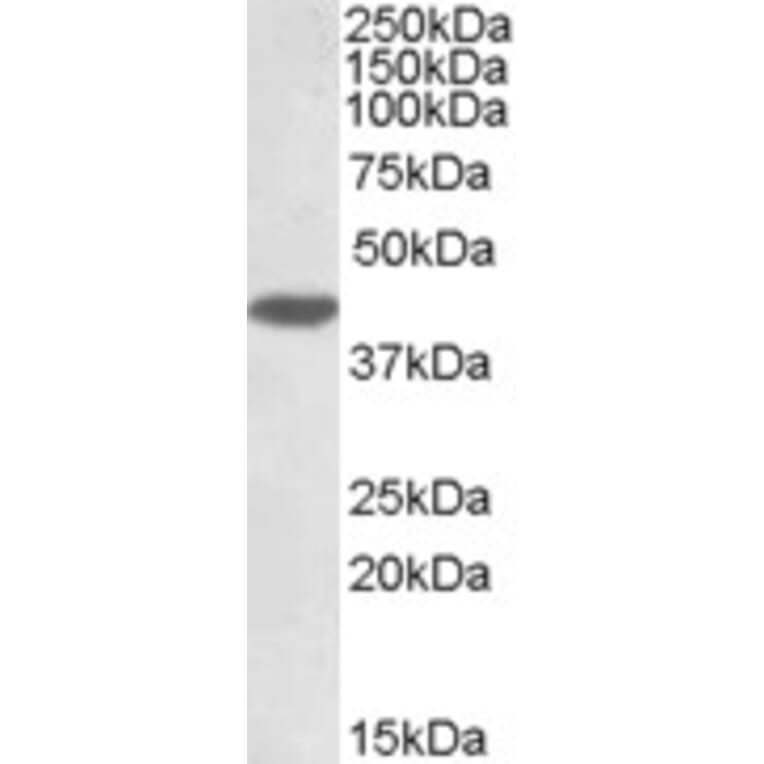 Western Blot - Anti-MKP-1 Antibody (A83788) - Antibodies.com
