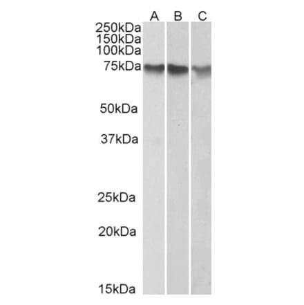 Western Blot - Anti-ATF2 Antibody (A83789) - Antibodies.com