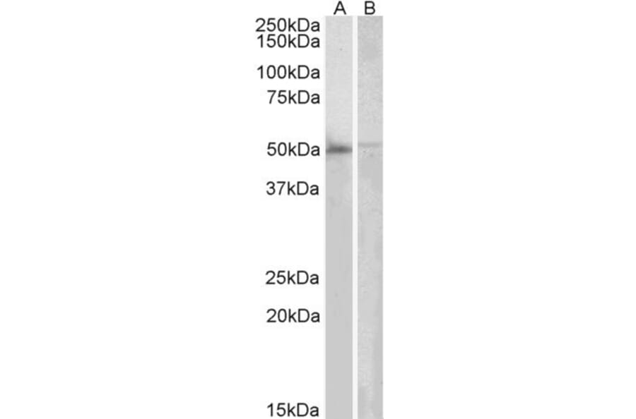 Western Blot - Anti-DOK3 Antibody (A83790) - Antibodies.com