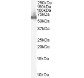 Western Blot - Anti-DOK3 Antibody (A83790) - Antibodies.com