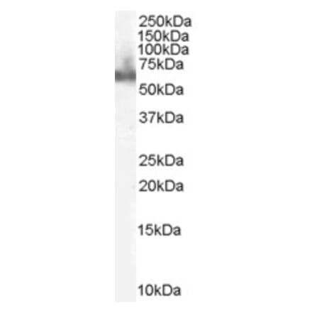 Western Blot - Anti-DOK3 Antibody (A83790) - Antibodies.com