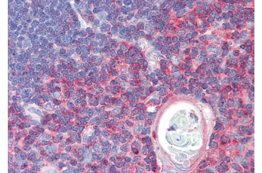 Immunohistochemistry - Anti-TXK/RLK Antibody (A83791) - Antibodies.com