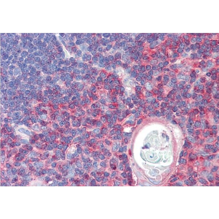 Immunohistochemistry - Anti-TXK/RLK Antibody (A83791) - Antibodies.com