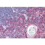 Immunohistochemistry - Anti-TXK/RLK Antibody (A83791) - Antibodies.com