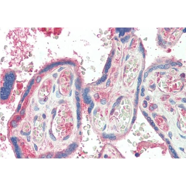 Immunohistochemistry - Anti-TXK/RLK Antibody (A83791) - Antibodies.com