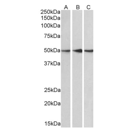 Western Blot - Anti-PPP2R5E Antibody (A83793) - Antibodies.com