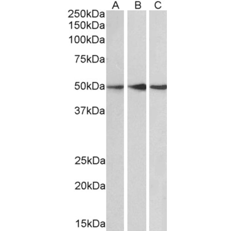 Western Blot - Anti-PPP2R5E Antibody (A83793) - Antibodies.com