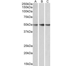 Western Blot - Anti-PPP2R5E Antibody (A83793) - Antibodies.com