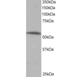 Western Blot - Anti-PPP2R5A Antibody (A83794) - Antibodies.com