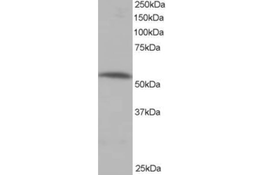 Western Blot - Anti-PPP2R5A Antibody (A83794) - Antibodies.com