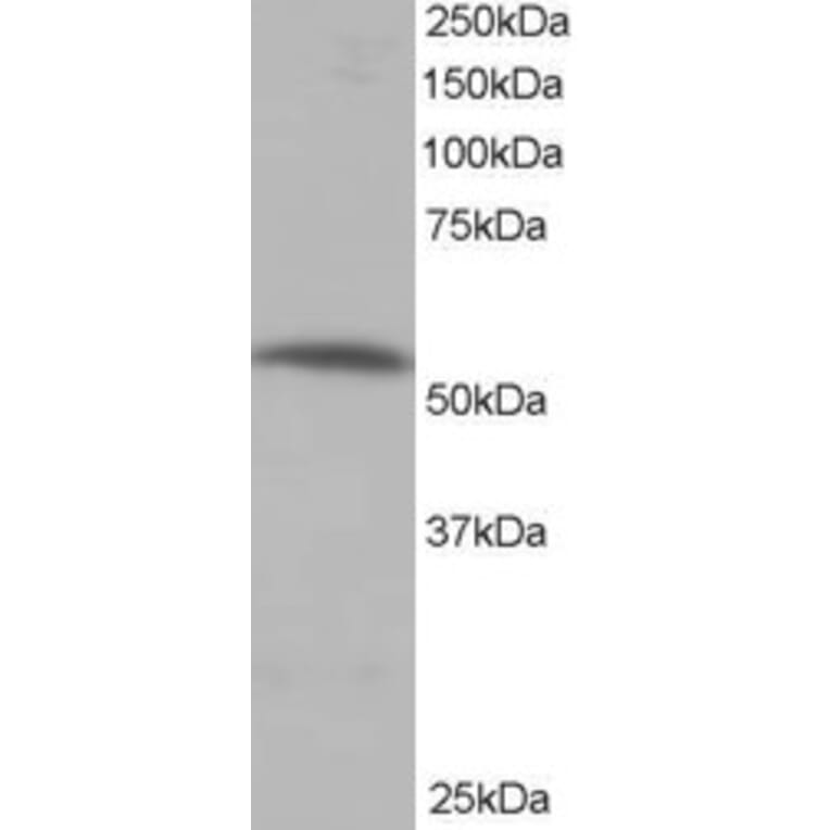 Western Blot - Anti-PPP2R5A Antibody (A83794) - Antibodies.com