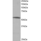 Western Blot - Anti-PPP2R5A Antibody (A83794) - Antibodies.com