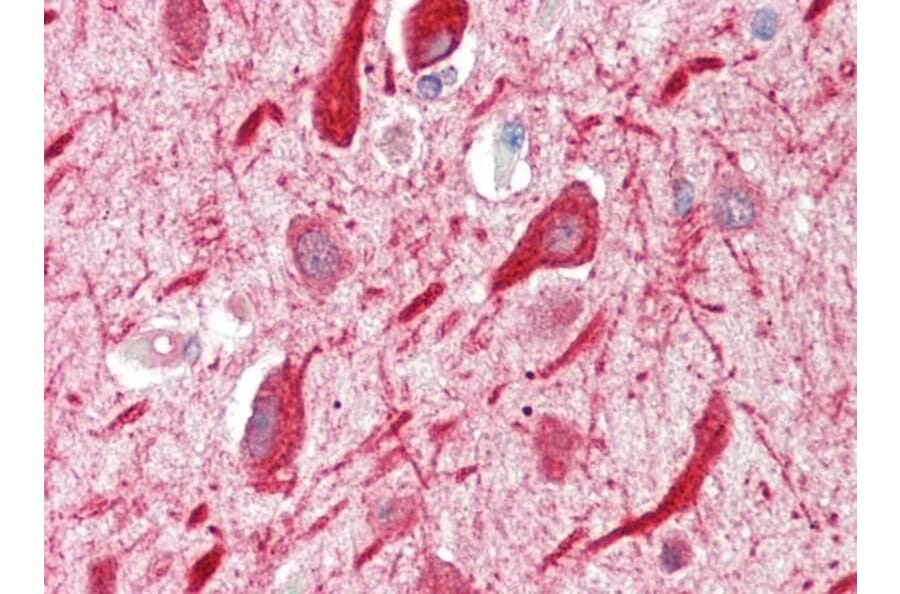 Immunohistochemistry - Anti-PPP2R5A Antibody (A83794) - Antibodies.com